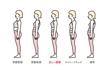 Sideways full body set illustration of correct posture and bad postureのイラスト素材