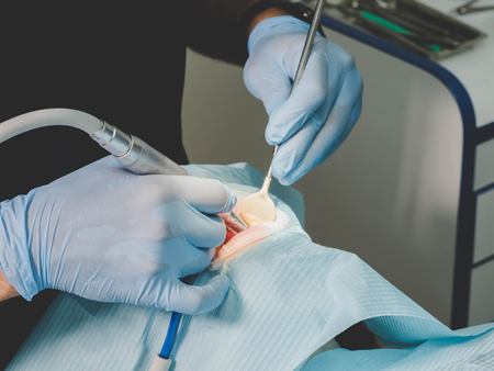 Doctor working with dental milling cnc machine. Spesialist prepare patient teeth for ceramic veneers with special tools. Cosmetic dentistry, medicine, stomatology concept.の写真素材