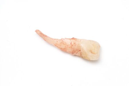 loosing of milk tooth, baby tooth or primary tooth, isolated on white background.の写真素材