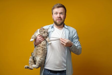 Upset man holds a cat and shows his tee-shirt, on which remains the fur of a moulting animal.の写真素材