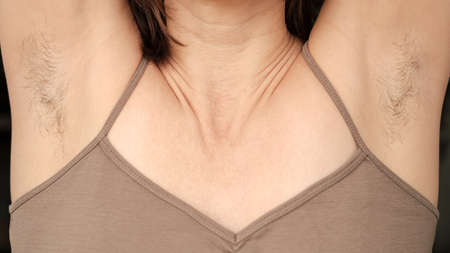 Hairy, unshaven female armpits and raised arms up. Concept of body positive and the adoption of its naturalness.の写真素材