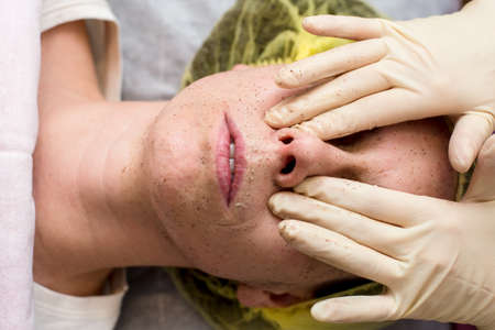 Beautician cleans the patient facial skin with massaging movements using a scrub. Top view.の写真素材
