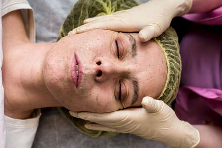 Beautician cleans the patient facial skin with massaging movements using a scrub. Top view.の写真素材