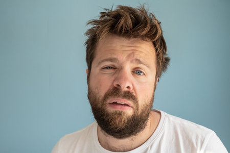 Bearded man with tousled hair and swollen, barely open eyes after a sleepless night, he suffers and...