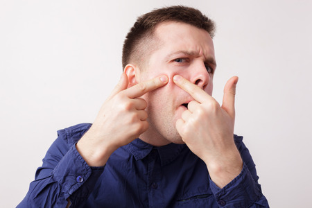 Young man squeezing a pimple on his cheekの写真素材
