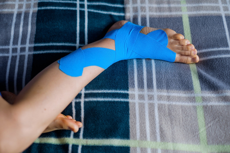 Elastic therapeutic blue tape applied to patients left leg.の写真素材
