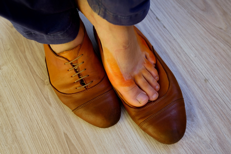 Woman skin on feet is colored in orange color with wet shoes of bad qualityの写真素材