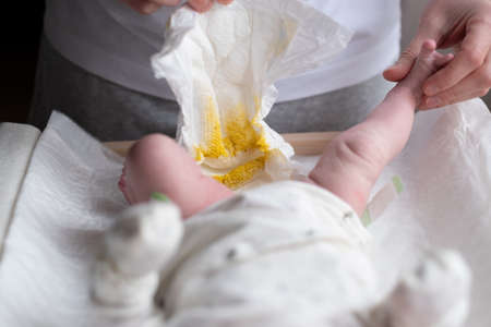Father changing dirty stinky diaper with yellow poop for his newborn babyの写真素材