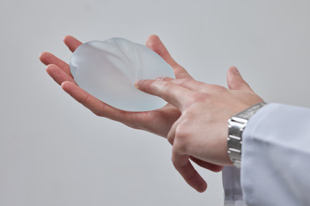 silicone breast implant in the hand of a plastic surgeon doctor, mastopexy concept, BREAST LIFTの写真素材
