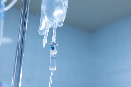 Close-up of IV infusion system with clear fluid bag in a hospital setting, used for patient hydration and treatment.の写真素材