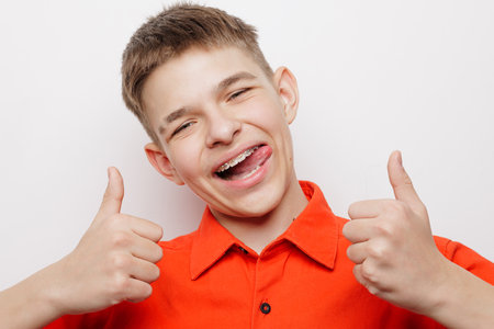 Happy teenage boy with dental braces giving thumbs up and smiling playfully, showing confidence and positivity.の写真素材