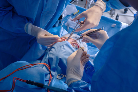 Surgeons performing precise blepharoplasty eyelid surgery, showing cosmetic procedure in sterile...