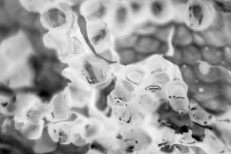 cancer cells under the microscope. Tissues affected by cancer cells under a microscope, Science. cancermedicine. chemistry and biology. - Imageの写真素材