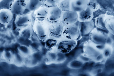 The cells under the microscope, or the cells under the microscope. Multiplication of bacteria or infection. Scientific experience. attacking cells - Imageの写真素材