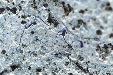 bacteria or cells under a microscope. Multiplication of bacteria or infection. Scientific...