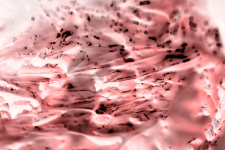 Tumor cells under a microscope. Tissues by affected cancer cells under a microscope, Nauka. cancer drugs. chemistry and biology.の写真素材