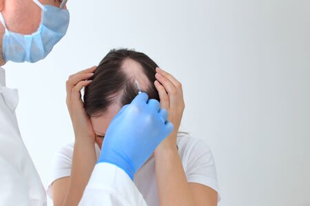 The injections in the bald head of a girl. Mesotherapy of the head. Treatment of alopecia. Alopecia areata in a young girl.の写真素材