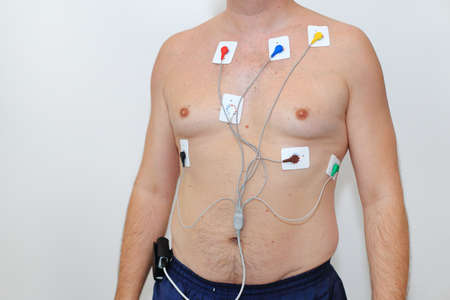 A man with a halter attached to his naked body. Medical device on the body of a man. Diagnosis of human diseases. Monitoring deviceの写真素材