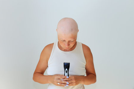 consequences of chemotherapy. Shaving off the last hair on the head with a razor. Head and razor. Total alopecia in a woman. Bald head. Hair in arms and bald headの写真素材