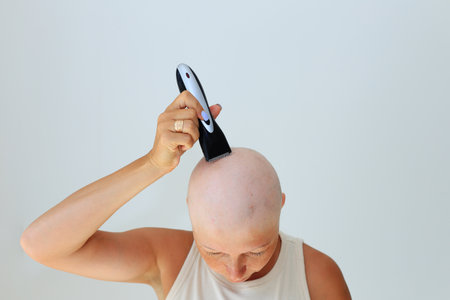 consequences of chemotherapy. Shaving off the last hair on the head with a razor. Head and razor. Total alopecia in a woman. Bald head. Hair in arms and bald headの写真素材
