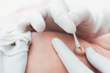 Mom or a doctor wearing gloves to handle the navel baby girlの写真素材