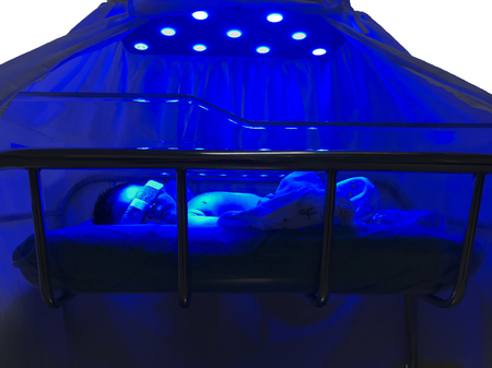 Newborn baby receiving UV phototherapy for jaundiceの写真素材