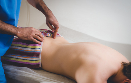 Young woman undergoing acupuncture treatment, closeupの写真素材