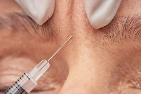 Beautician giving an injection to female wrinkleの写真素材