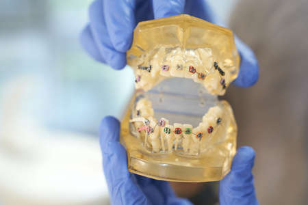 Dentist in gloves demonstrating braces system on teeth