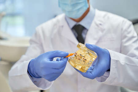 Mold of teeth with braces being worked on by dentistの写真素材