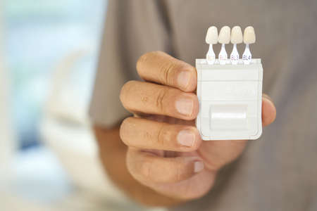 Dental specialist presenting teeth-whitening kit with samplesの写真素材