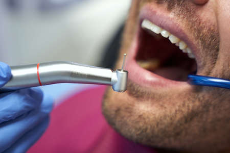 Man keeping mouth open for dental treatmentの写真素材