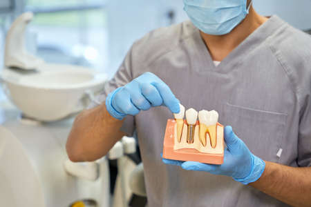 Skillful dental technician showing anatomy of dental implantの写真素材