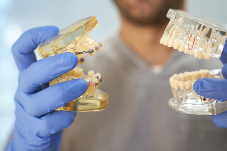 Dentist in gloves demonstrating two teeth replicasの写真素材