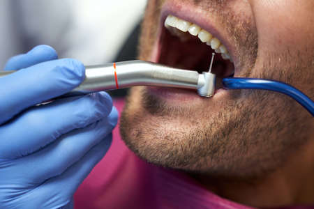 Man getting his teeth fixed at dental clinicの写真素材