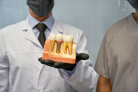Dental technicians presenting a model of artificial tooth implantの写真素材