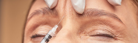 Anti Aging procedures. Close up shot of beautician in protective gloves making cosmetic injection in female foreheadの写真素材