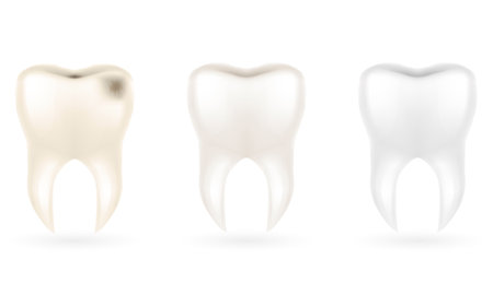 human root tooth model vector illustration isolated on white backgroundのイラスト素材