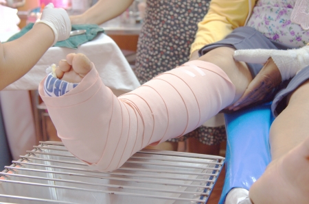 bandaged legの写真素材
