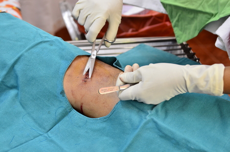 Doctor cutting thread の写真素材