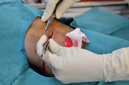Suturing の写真素材