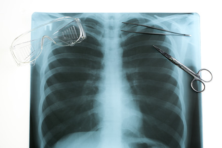 Doctor's desk, medical concept. X-ray and protective glasses
