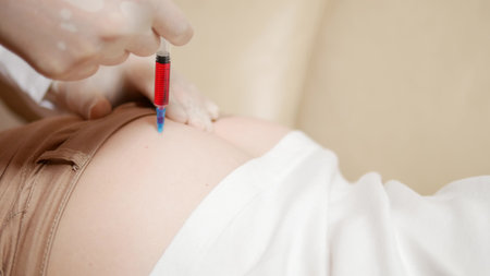 close-up, the doctor puts an injection into the buttock of the patient.の写真素材