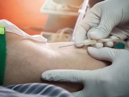 Nurse stabbing medical needles to donor arm. Blood Donor Making Donation In Hospital.の写真素材