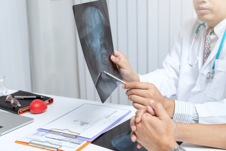 Medical and health care concept. Doctor explaining x-ray results to patient while sitting at the table in office.の写真素材