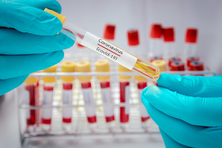 Test tubes containing plasma extracted from the blood of people who had been ill with coronavirus,...