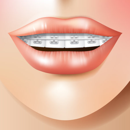 Orthodontic careのイラスト素材