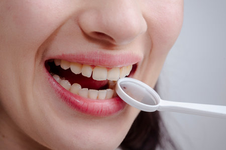 Dental clinic. Teeth examined at dentists. Healthy woman teeth and a dentist mouth mirror. Ideal teeth. Dental tools and white tooth. Close up teeth with dental mirror. Dental treatment.の写真素材