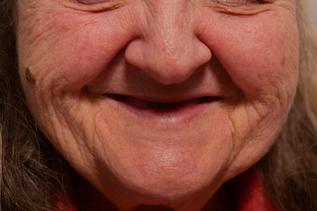 Old woman smiling face. Old woman closeup portrait. Wrinkles. Facial skin problems. Blemishes and...