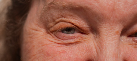 Old woman wrinkle face. Old woman closeup portrait. Wrinkles. Facial skin problems. Blemishes and...